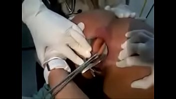 dildo removed from girl's anus